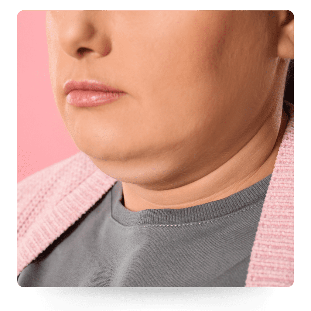 metaponin malaysia double chin