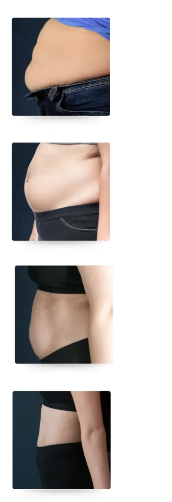 metaponin malaysia 3 bulan scale 1